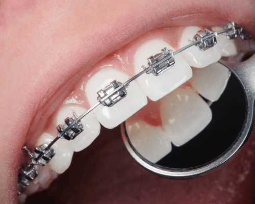 Orthodontic